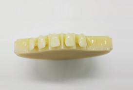 Mehrschichtiger Gradientenharzblock 3 (Multi-layer Gradient Resin Disc 3) – Chongqing Zotion Dentistry Technology Co Ltd, Milling Blocks & Blanks