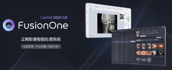 FusionOne System zur intelligenten Verarbeitung von kieferorthopädischen Bildern