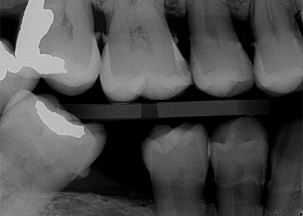 IRIS Smart Imaging