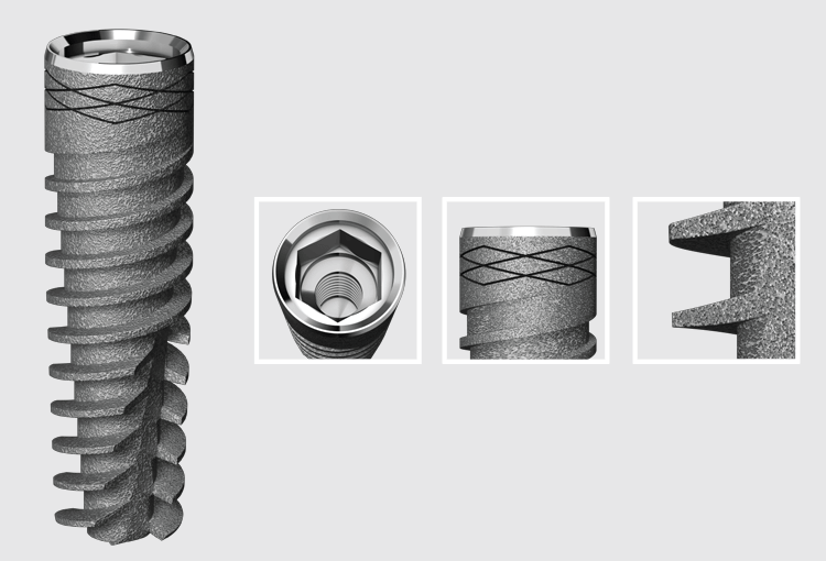 I5 Conical implant – AB Dental Devices Ltd., Implant Systems