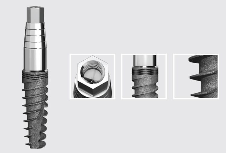 I7 Integral implant – AB Dental Devices Ltd., Implantate