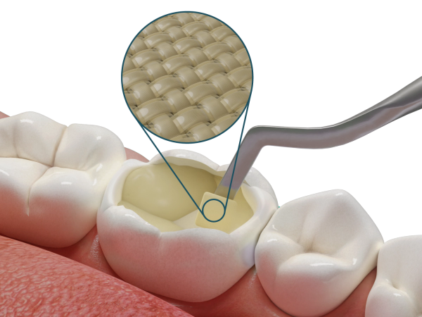 Fibrafill® CUBE