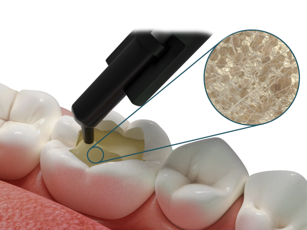 Fibrafill® DENTIN