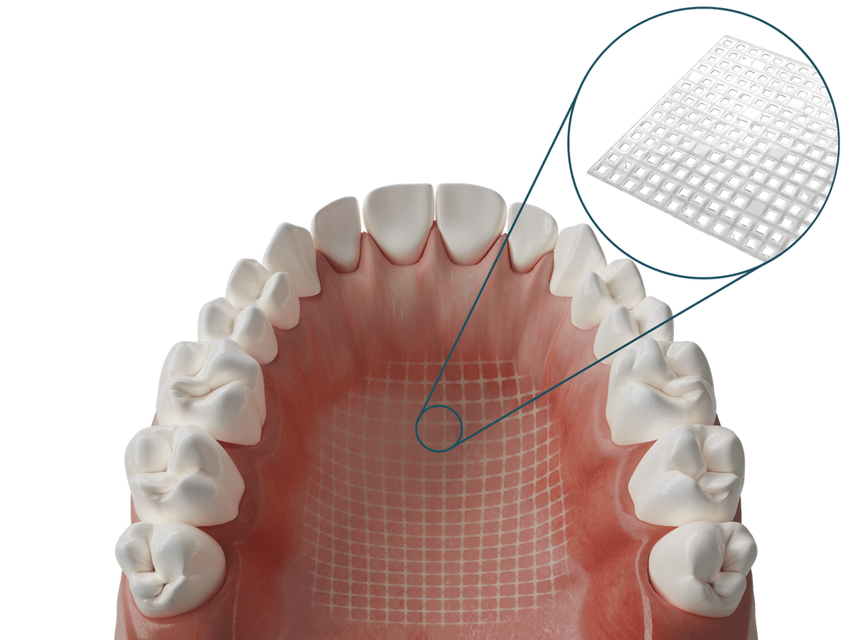 Dentapreg® MESH Transparent – ADM Dentapreg & Fibrafill, Denture Resins