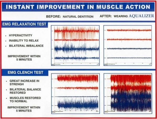 Aqualizer®