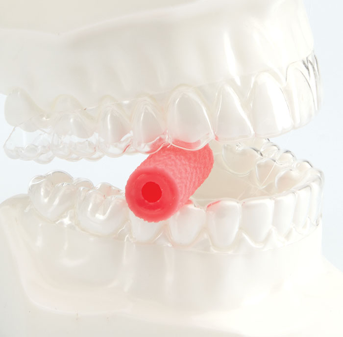 DYNAFLEX ALIGNER SEATERS – Dynaflex Orthodontics USA, Clear Aligners
