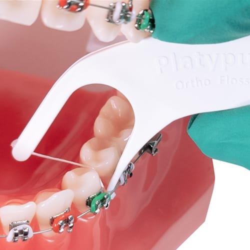 THE DYNAFLEX PLATYPUS KIEFERORTHOPÄDISCHER ZAHNSEIDENTRÄGER – Dynaflex Orthodontics USA, Intraorale Geräte