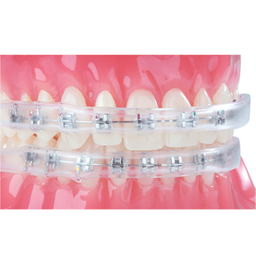 ACT Mundspülung – Dynaflex Orthodontics USA, Mouthwash & Oral Rinses