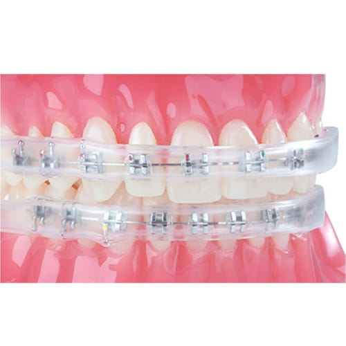 Bain de bouche ACT – Dynaflex Orthodontics USA, Mouth Rinse Solutions