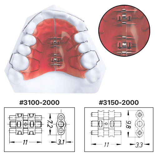 Vis d'expansion – Dynaflex Orthodontics USA, Intraoral Appliances