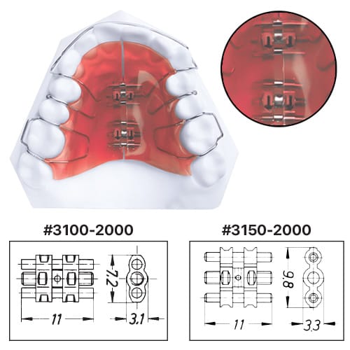 Vis d'expansion – Dynaflex Orthodontics USA, Intraoral Appliances