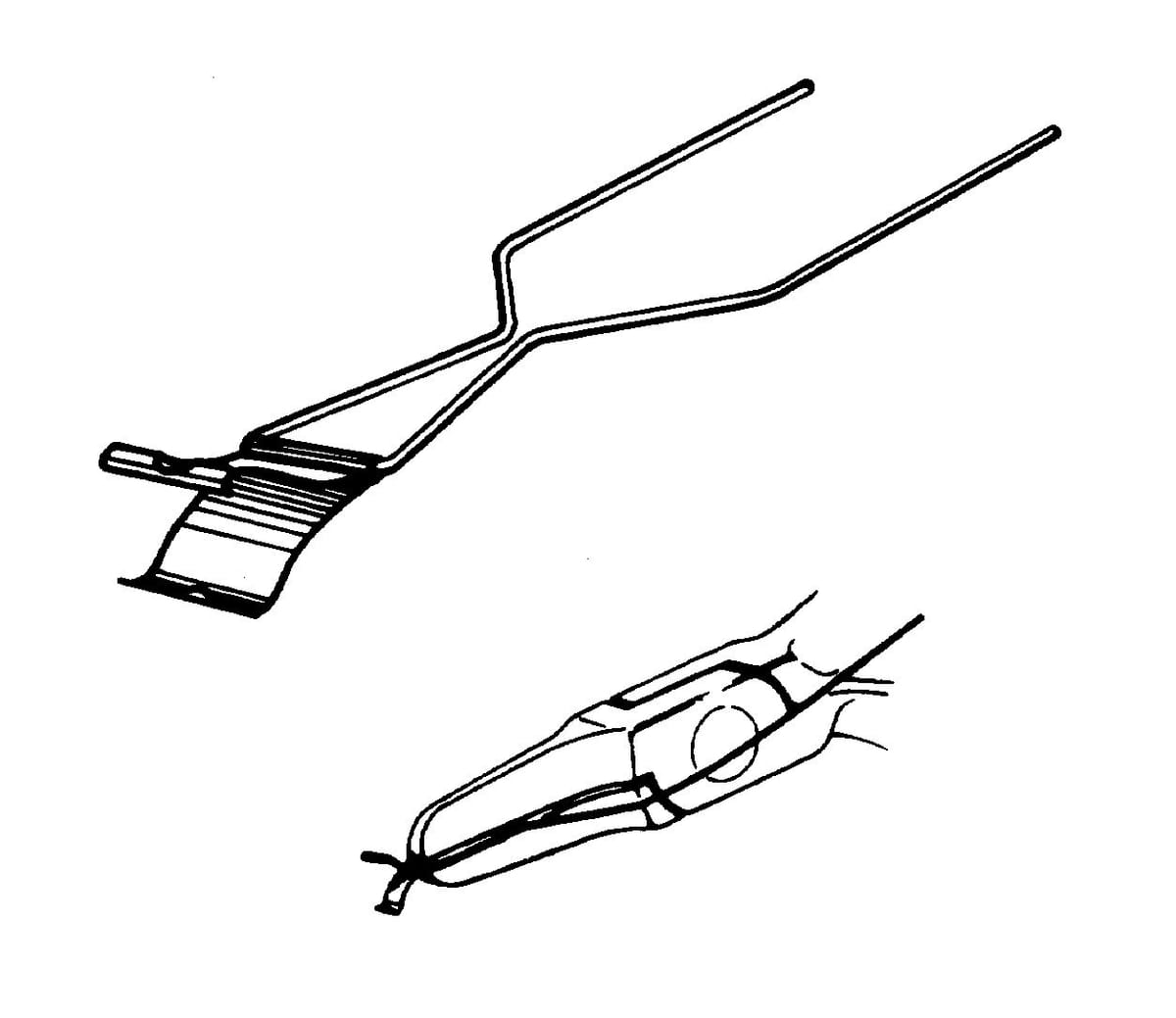 3M™ Unitek™ Steiner Rotationsfeder Keil 7000024865 – solventum, Connecting Elements