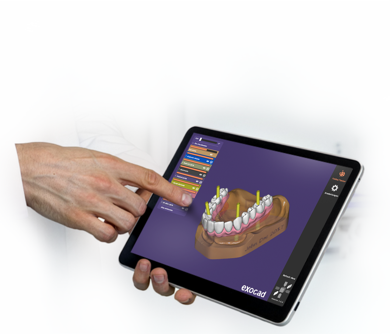 exocad webview