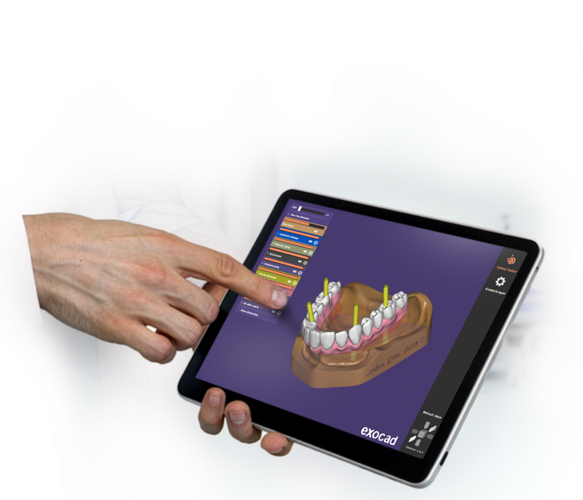 exocad webview – Exocad, CAD/CAM Software