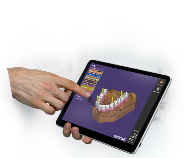 exocad webview