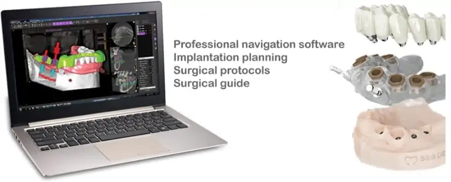 B&B Dental GS – Software Chirurgia Guidata – B&B Dental SRL, CAD/CAM-Software