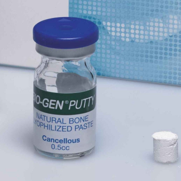 Sostituti Ossei Naturali – Putty – BIOACTIVA Srl, Bone Graft Materials