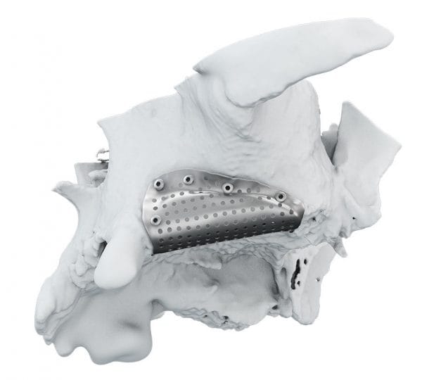 Griglia 3D