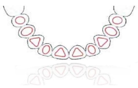 WINPeek® – BioSAF IN, Abutments