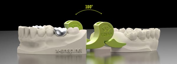 xSNAP 360