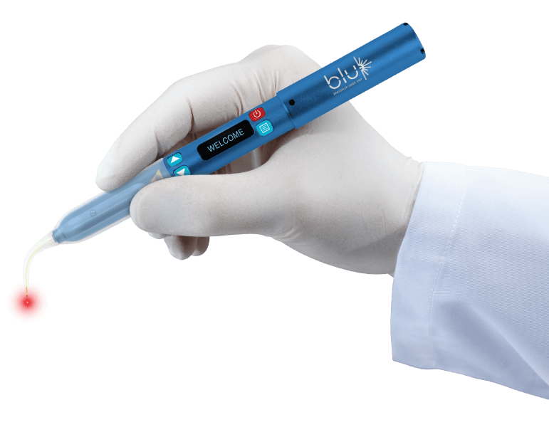 BLU Dental Microlaser – Brasseler, Dental Lasers