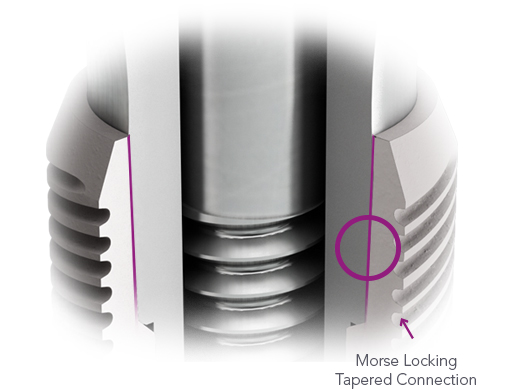 CONICAL IMPLANT