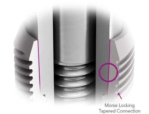 CONICAL IMPLANT – Brat Implants, Implantology