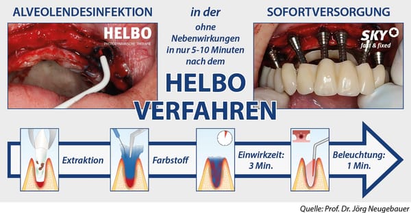 HELBO - Thérapie photodynamique antimicrobienne