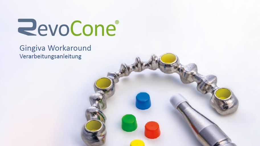 RevoCone Gingivales Workaround – bredent GmbH & Co.KG, Implant Components & Abutments