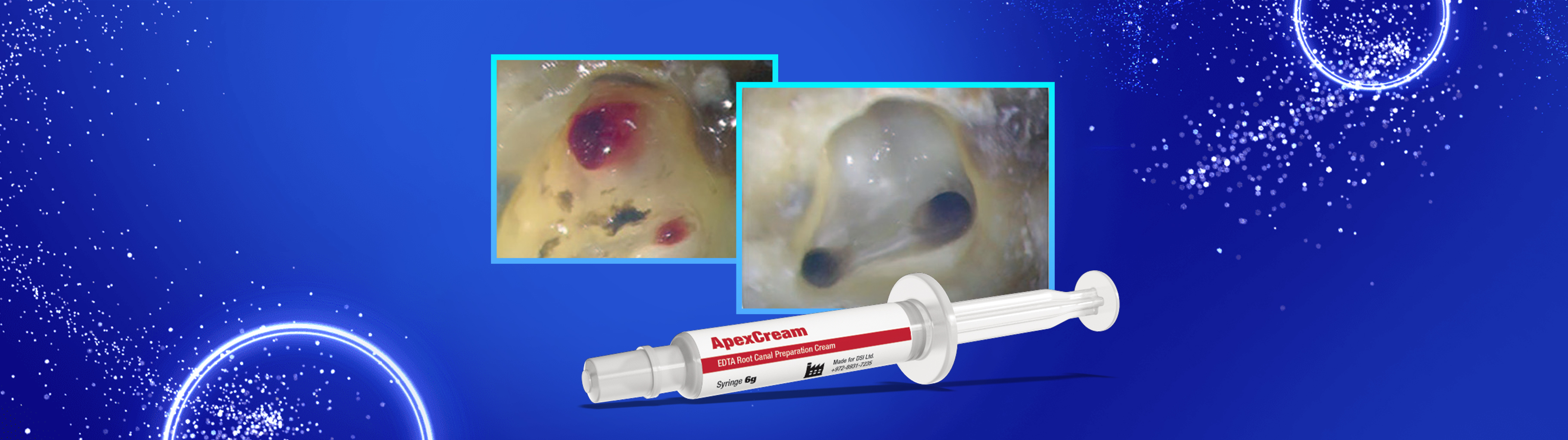 DSI ApexCream Root Canal Prep – DSI Dental Solutions Ltd, Canal Preparation Solutions