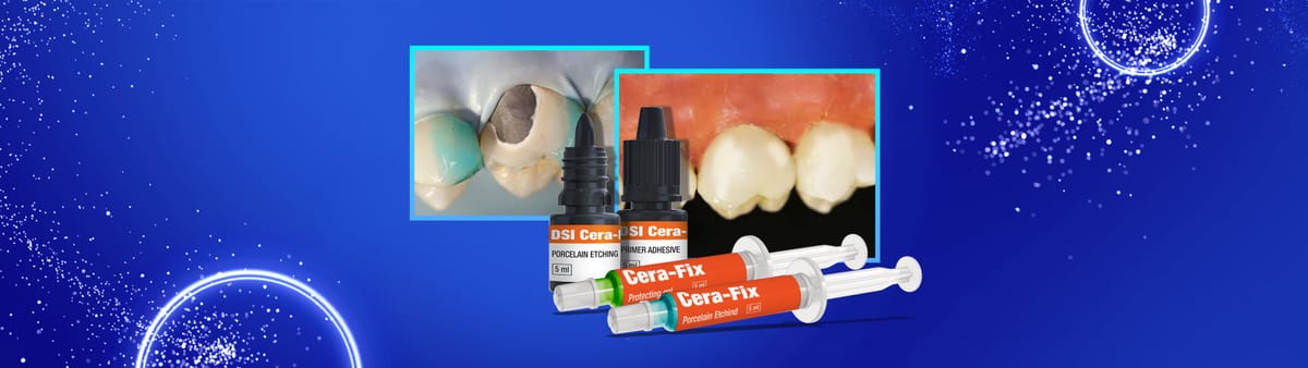 DSI Cera-Fix Repair Kit – DSI Dental Solutions Ltd, Cements