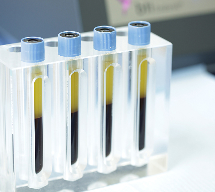 BTI – PRGF Endoret