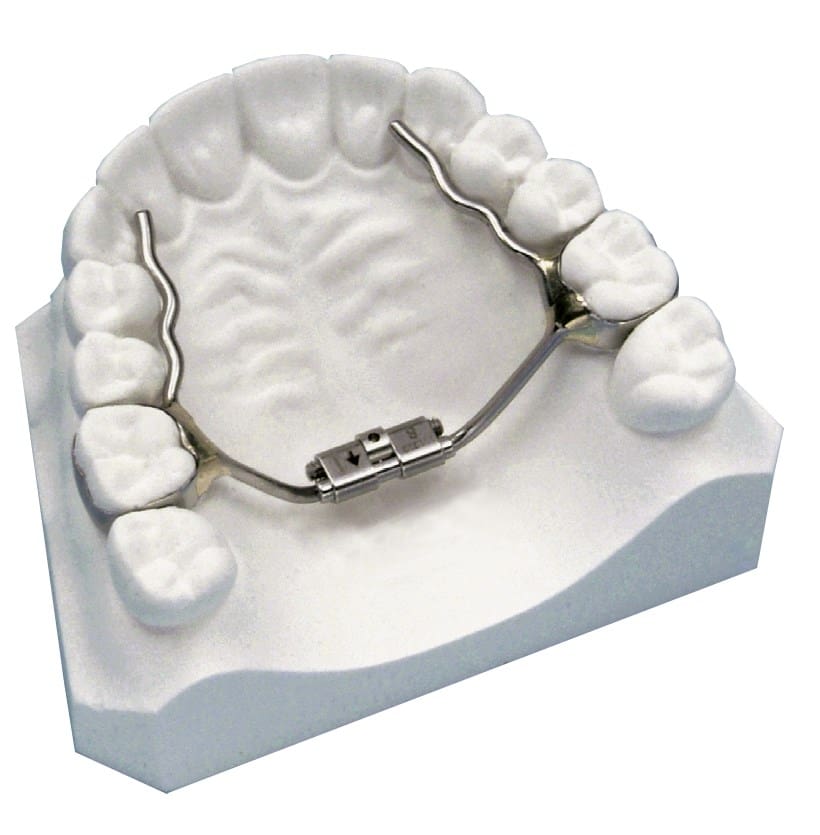 Disjoncteur palatin micro rapide – RMO, Intraoral Appliances