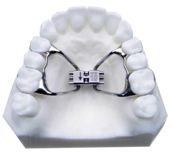 EXPANSION RAPID DBL ORTHOGONAL 10MM W/KEY