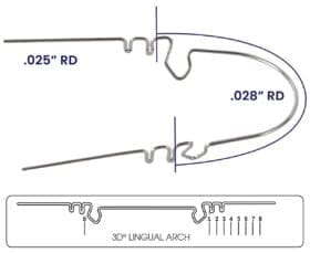 Wilson 3D Lingual Arch Pack of 3 – RMO