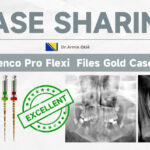 Pro Flexi Gold