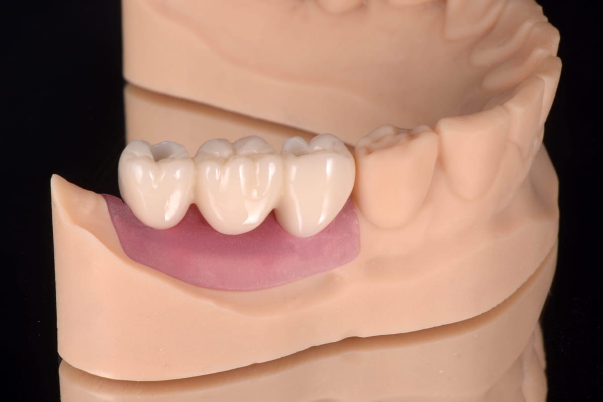 DH Print プロビジョナル CB – Denken-Highdental Co., Ltd., Druckharze