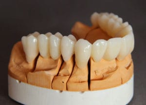 Dentalos Plus SG1a