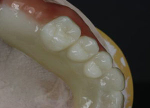 Dentalos Plus Mono Blanks