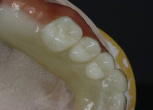 Dentalos Plus SG2