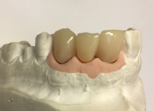 Dentalos Plus SG3a