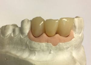 Dentalos Plus SG3a