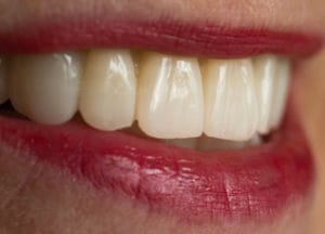 Dentalos Plus SG4a