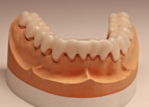 Dentalos Plus SG5a