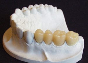 Dentalos Plus SG6a
