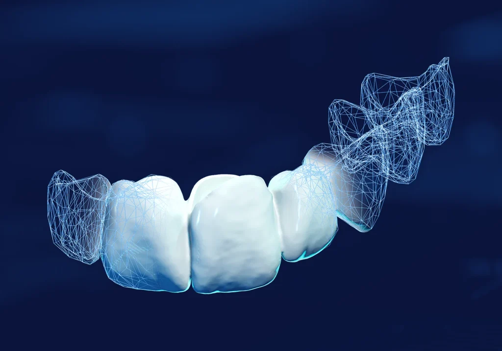 DentaTEMP – DentalTwin, CAD/CAM Software