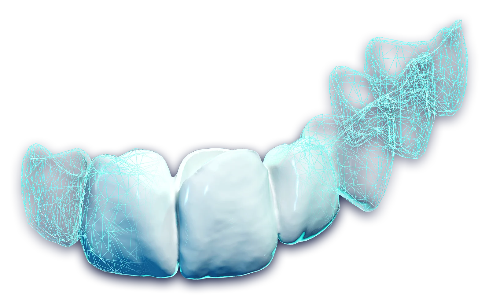 DentaBRIDGE – DentalTwin, CAD/CAM Software