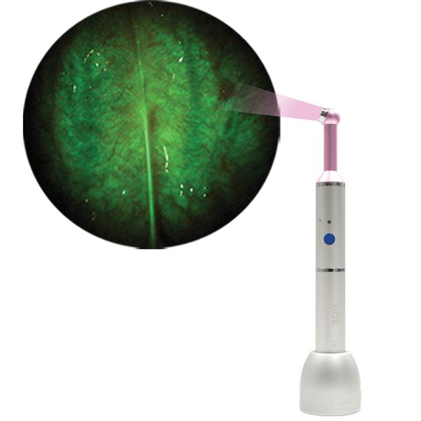 DOE SE - DentLight