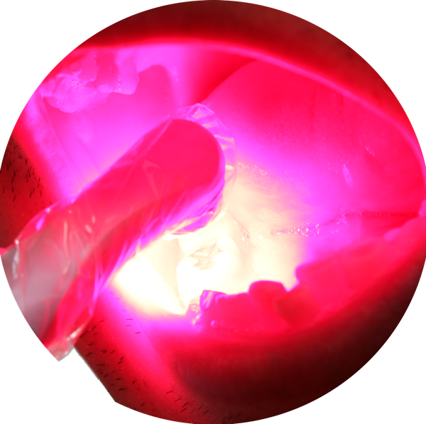 FUSION PBM Light