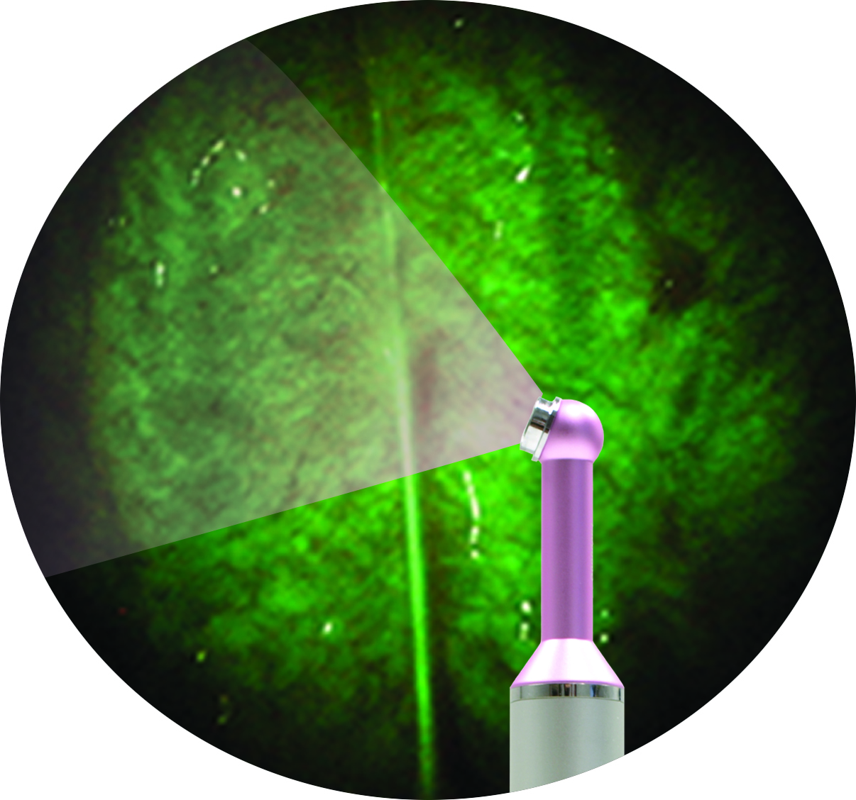 DentLight FUSION DOE - Oral Examination and Caries Detection Device